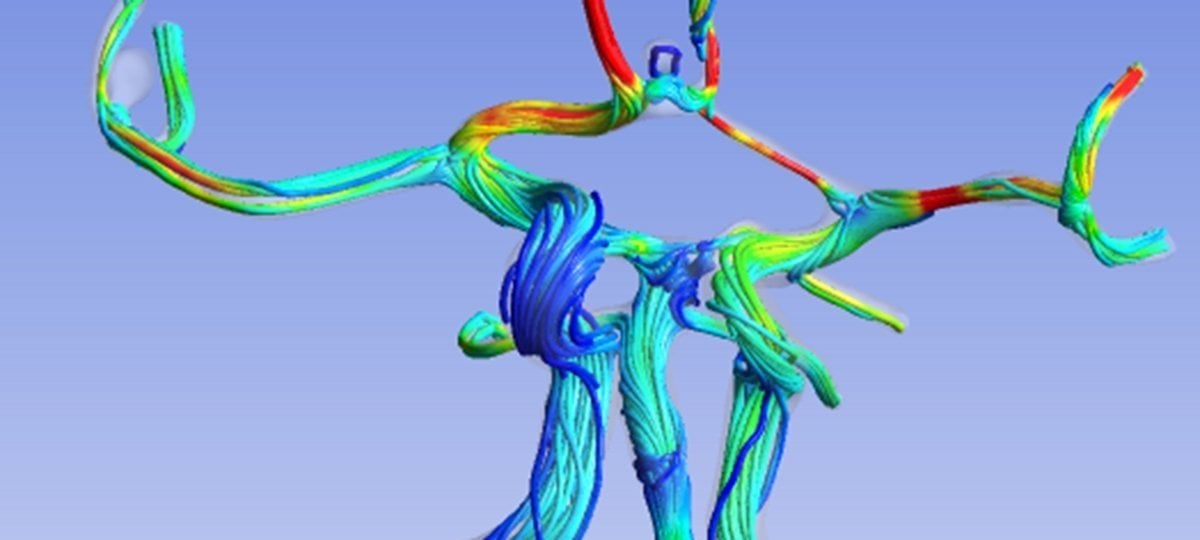 Streamflow visualization of bloodflow.